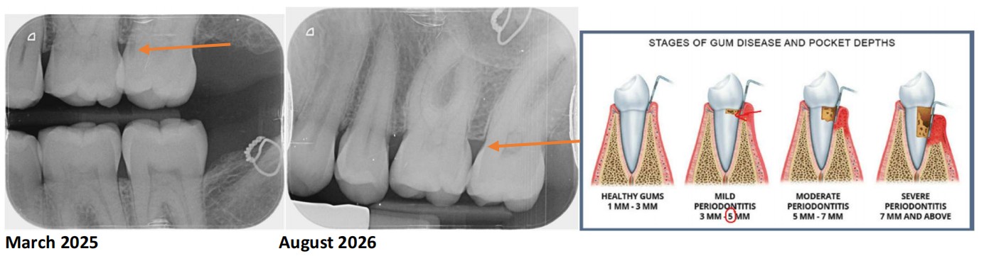 dental xray